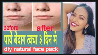 ऐसा फेसपॅक जो आपके सारे skin problems को ठीक कर देगा | facepack for every skin problem | hindi