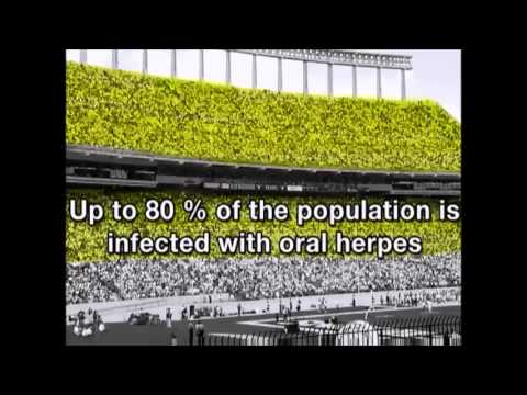 one minute cure herpes review one minute cure herpes review