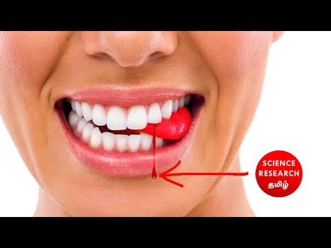 நாக்கைக் கடித்தால் என்ன ஆகும்? | what happen if we #bite #tongue