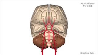 脳動脈瘤／2分で分かる医療動画辞典　ミルメディカル