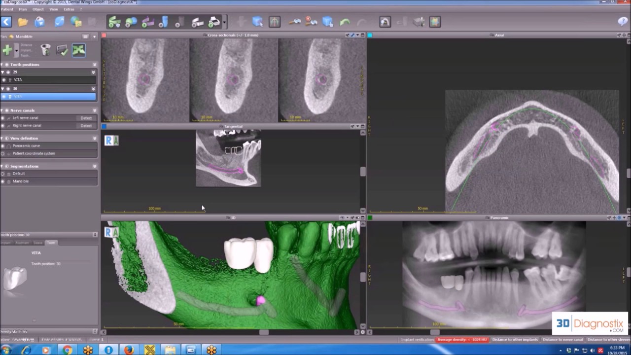 coDiagnostiX Training  - [3 of 3]