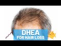 Dhea for hair loss  is it effective or not