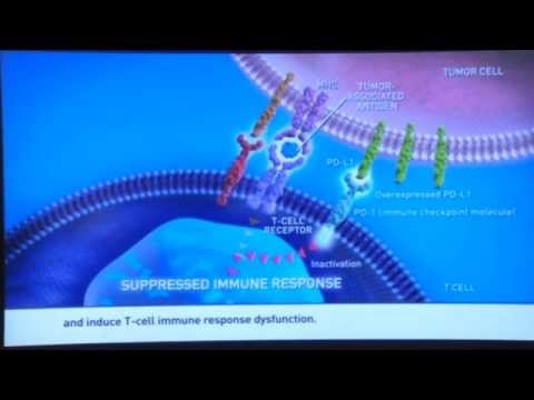 Video: Anticorpo Monoclonale Anti-PD-1 MEDI0680 In Uno Studio Di Fase I Su Pazienti Con Neoplasie Solide Avanzate