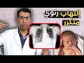 ليه الالتهاب الرئوي بيتكرر عند الأطفال الأسباب والعلاج مع د محمد حامد