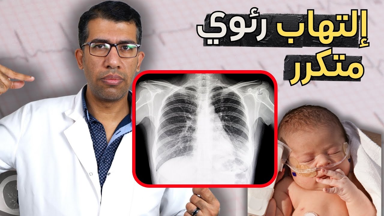 ليه الالتهاب الرئوي بيتكرر عند الأطفال؟ 😷 الأسباب والعلاج مع د. محمد حامد 👨‍⚕️