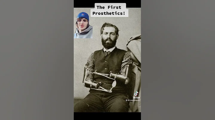 Union Soldier Samuel Decker Invented Prosthetic Ar...