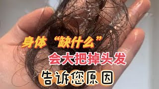 身体“缺”什么会大把掉头发？原因告诉您，秀发自己长出来