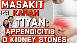 Masakit sa Kanan ng Tiyan: Appendicitis or Kidney Stone (Repost Video)