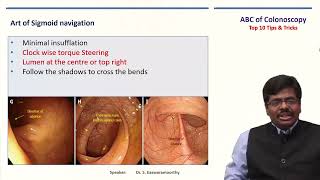ABC of  Colonoscopy