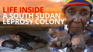 Rare look inside a Leprosy Colony in South Sudan | EWTN News In Depth