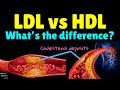 Whats the difference between ldl andl  ldl vsl  bad cholesterol vs good cholesterol