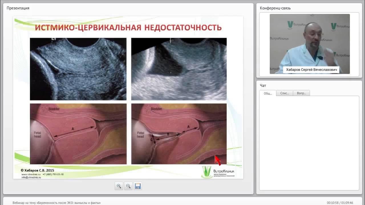 Отзывы кто забеременел после. Беременность после ВРТ. Ведение беременности после эко клинические рекомендации. Ведение беременности после эко книги. Как забеременеть через эко.