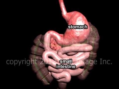 Billroth 2 Surgery video - Trial Image Inc. Animation by Cal Shipley, M.D.