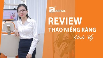 [Review niềng răng]: #8 Kết quả niềng răng của Ánh Vy