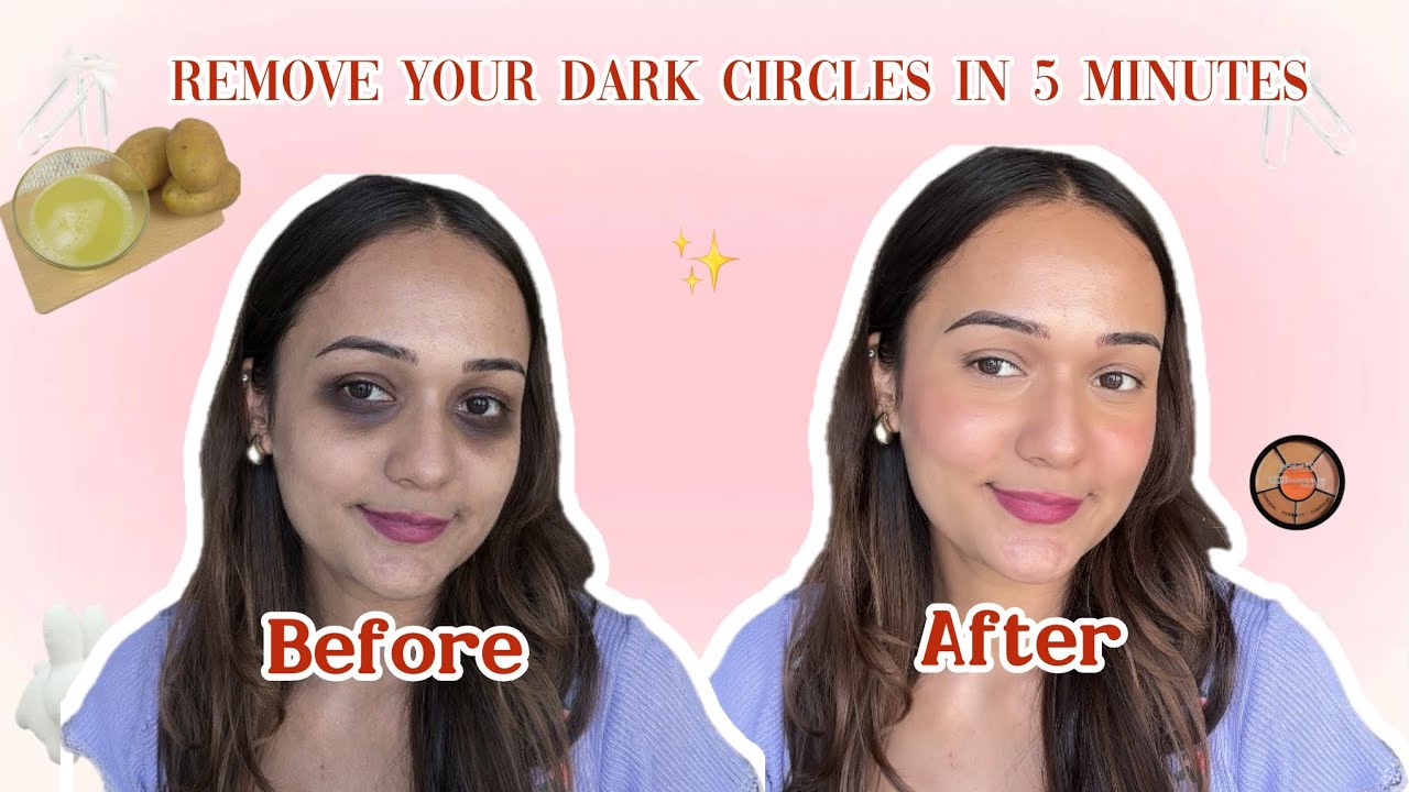 Sirf 5 minute mein dark circles gayab?! 😳✨|| Proof that dark circles can disappear in 5 minutes 😱