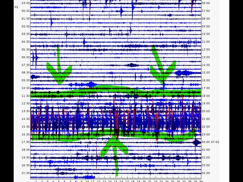 Yellowstone Earthquake swarm continues... Interesting readings on seismographs.. update 7/1/2021