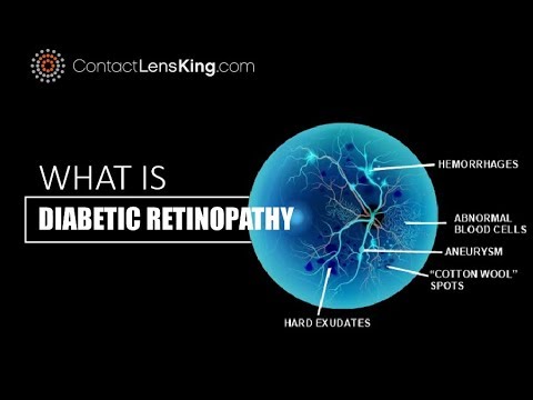 what-is-diabetic-retinopathy?