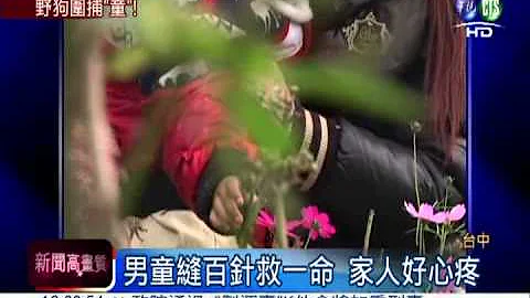 野狗发狂围攻 撕咬2岁童缝百针 - 天天要闻