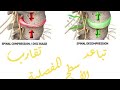 الخشونة والمفاصل والفقرات المضغوطة وتباعد الأسطح المفصلية Joint Decompression الخشونة والمفاصل والفقرات المضغوطة وتباعد الأسطح المفصلية Joint Decompression