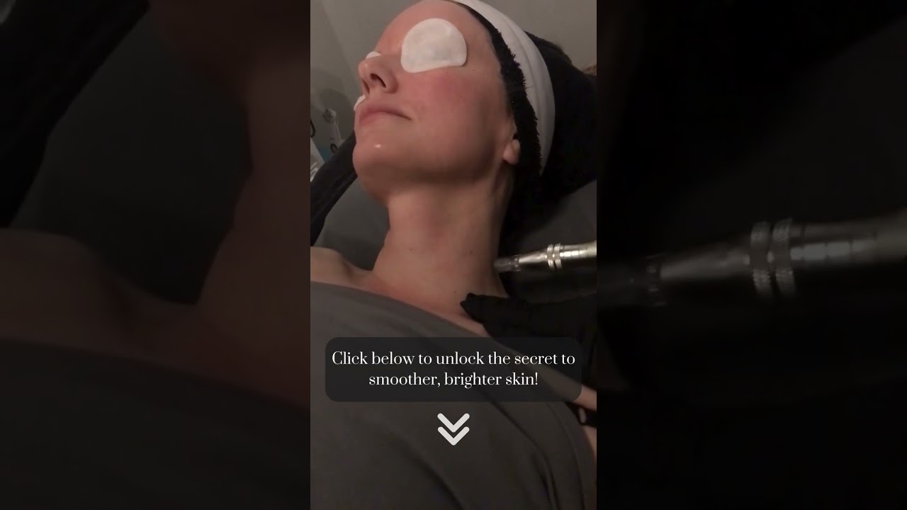 ✨ Curious about how Nano Infusion can transform your skin? Keep reading! ✨