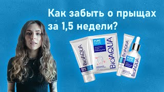 НЕТ ПРЫЩАМ, УГРЯМ И АКНЕ ! | Уход за проблемной кожей | Набор антиакне Bioaqua Pure Skin - Видео от Красна Девица