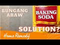 Home Remedy Para sa Bungang Araw | Elizabeth Veloso