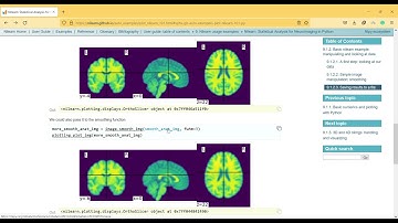 Nilearn Package of Python Simple example
