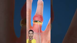 Ring 💍#shorts #flossroll #doctor #science #3danimation #lifehacks #facts #stuckring