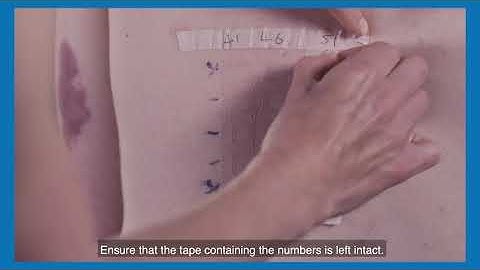 A guide to removing your patch tests at home