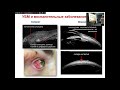 «Современные ультразвуковые исследования в офтальмологии»