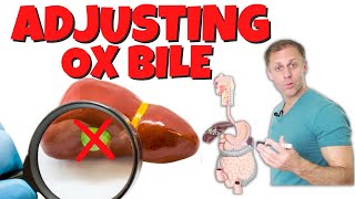 How to Adjust Ox Bile Dose and Timing with No Gallbladder