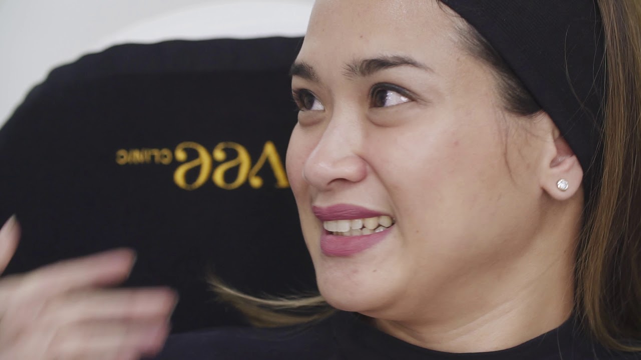 ULTHERA & XEOMIN GIVEAWAY | MAKING FRIENDS SMILE AT THE AIVEE CLINIC