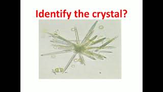 1. Quizlet for Urinary Crystals #MLTLectures 3 Quizlet For Urinary Cast Mltlectures