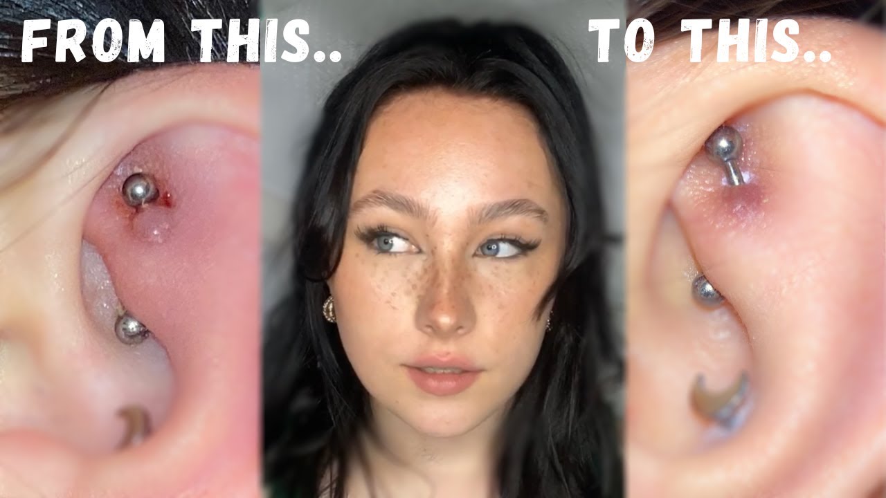 How To Heal A Helix Piercing In ONE WEEK YouTube How To Heal A Helix Piercing In ONE WEEK YouTube