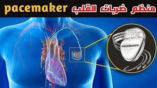 ماهو منظم ضربات القلب؟! وكيف يعمل.. What is a pacemaker?! and how does it work screenshot 2