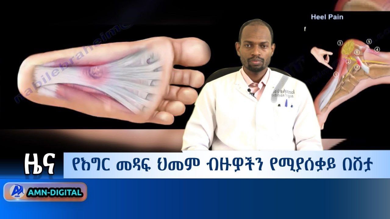 የእግር መዳፍ ህመም ብዙዎችን የሚያሰቃይ በሽታ