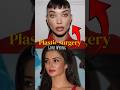 Plastic Surgery Gone Wrong | #anushkasharma #ayeshatakia #bollywood #actress