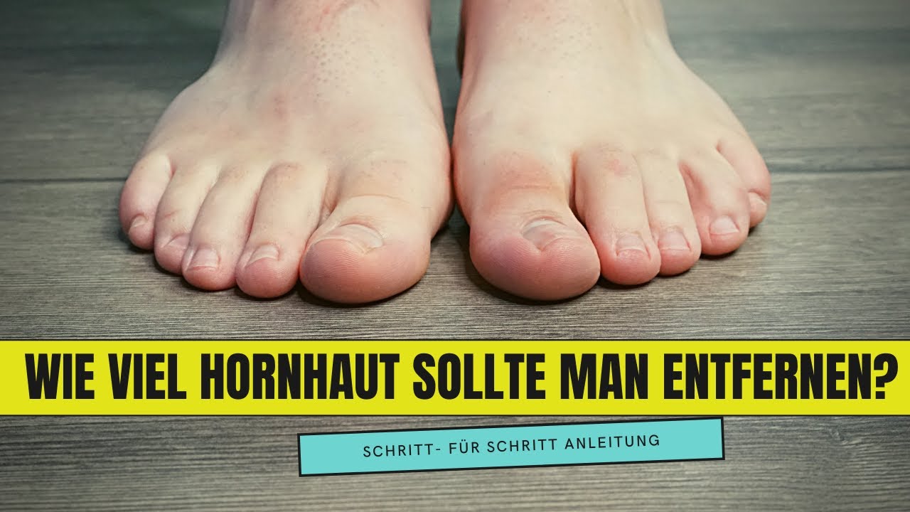 Wie viel HORNHAUT sollte man bei einer FUSSPFLEGEBEHANDLUNG entfernen