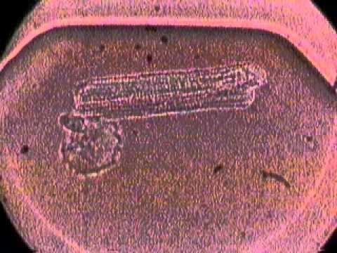 Heart Muscle cell contraction.wmv - YouTube