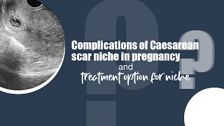 Complications of Caesarean scar niche in pregnancy. Treatment options for niche.