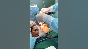 Bác sĩ Tú Dung CĂNG DA MẶT SMAS trẻ 10 tuổi sau 1 giấc ngủ