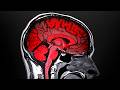 What Counter Strike Does to Your Brain What Counter Strike Does to Your Brain