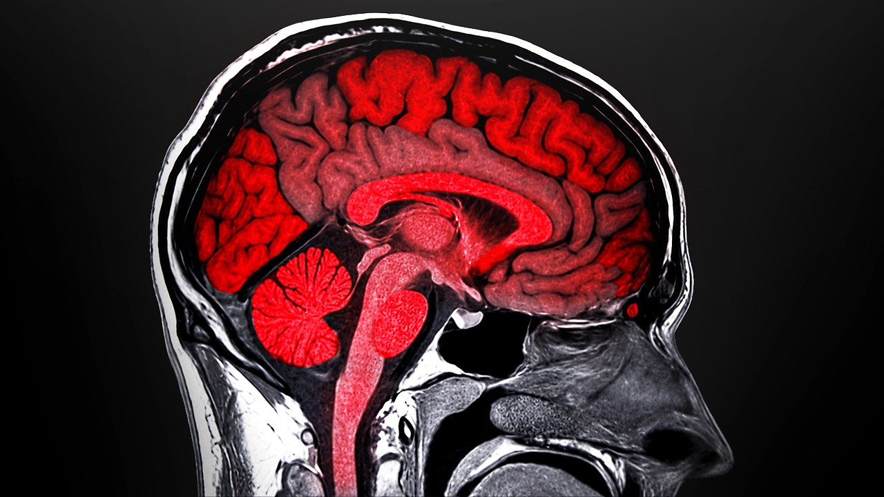 What Counter-Strike Does to Your Brain