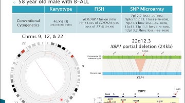 Adoption of Optical Genome Mapping in Clinical Cancer Cytogenetic Laboratory: a Stepwise Approach