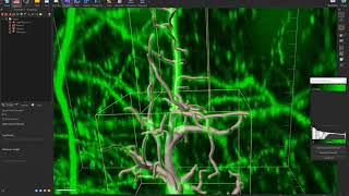 Lesson 14 - Imaris Filament Tracer II - Editing Filament and Detecting Complex Neuronal Structures