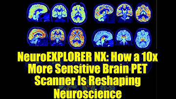 NeuroEXPLORER NX: How a 10x More Sensitive Brain PET Scanner Is Reshaping Neuroscience