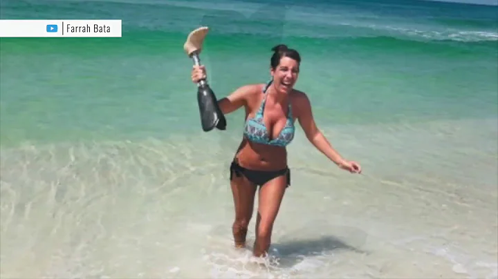 Women find prosthetic leg in PCB, track owner