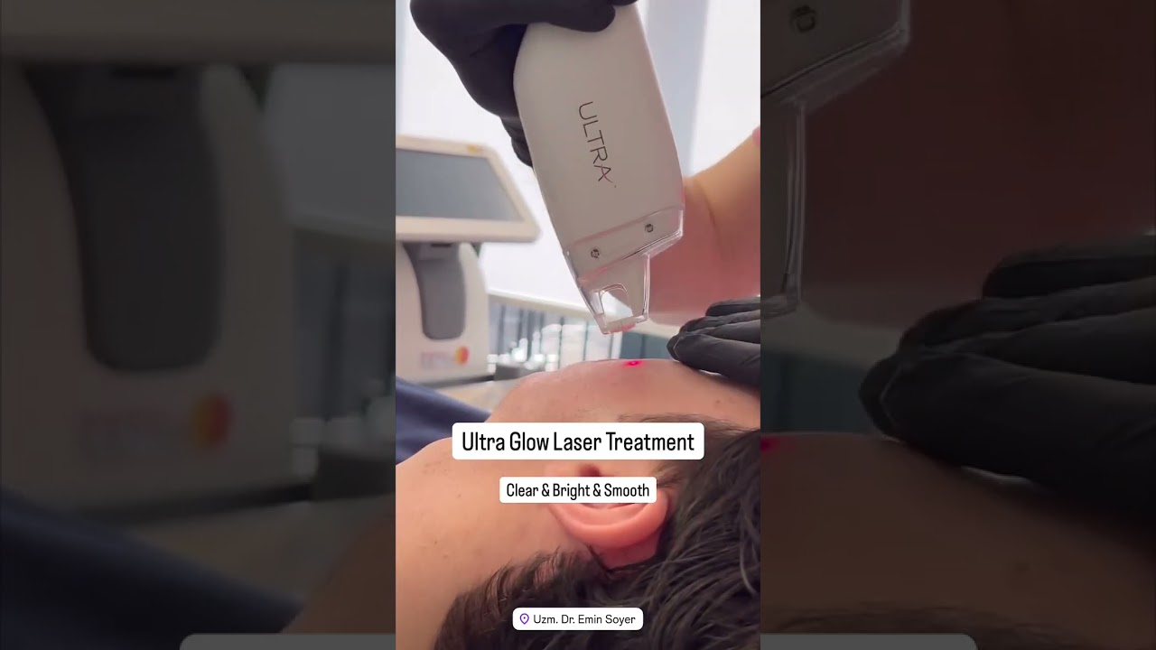 Ultra Glow Laser Treatment: Clear, Bright & Smooth Skin ✨ | Dr. Emin Soyer