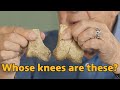 Reading the bones: What can we tell about age or sex from fossils like Lucy? | Lucy's Lasting Legacy