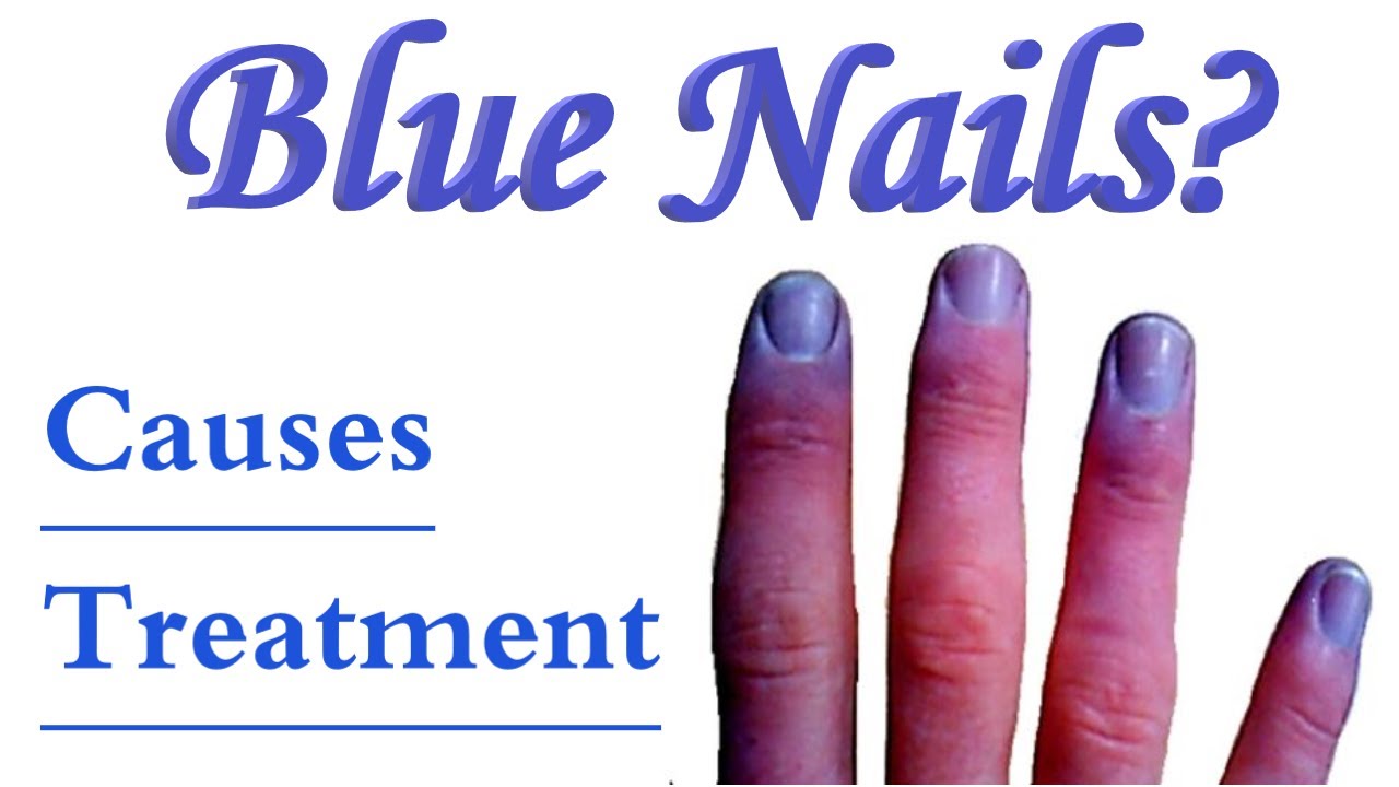 What do your fingernails say about your health? | Healthing.ca